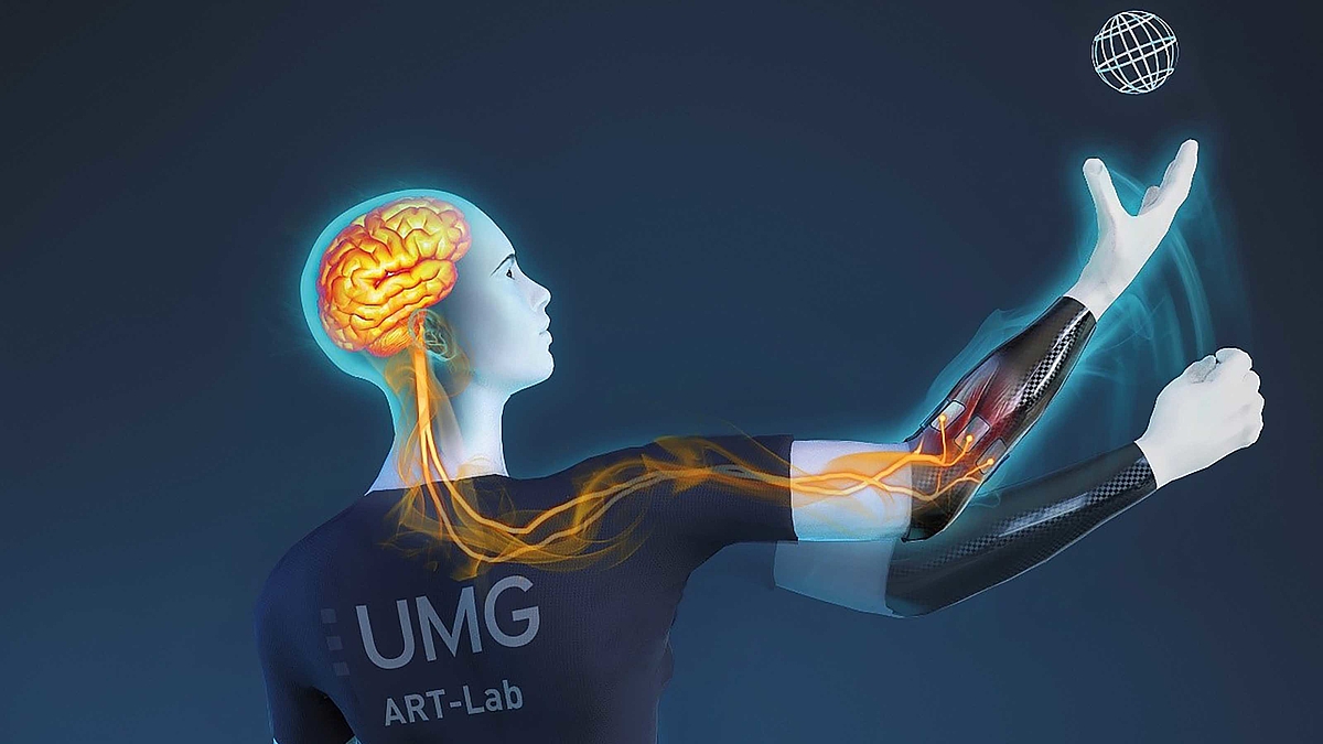Eine animierte Figur bewegt den Arm mit der Prothese nach oben. Die neuronalen Vernetzungen führen vom Gehirn der Figur zu der Prothese.