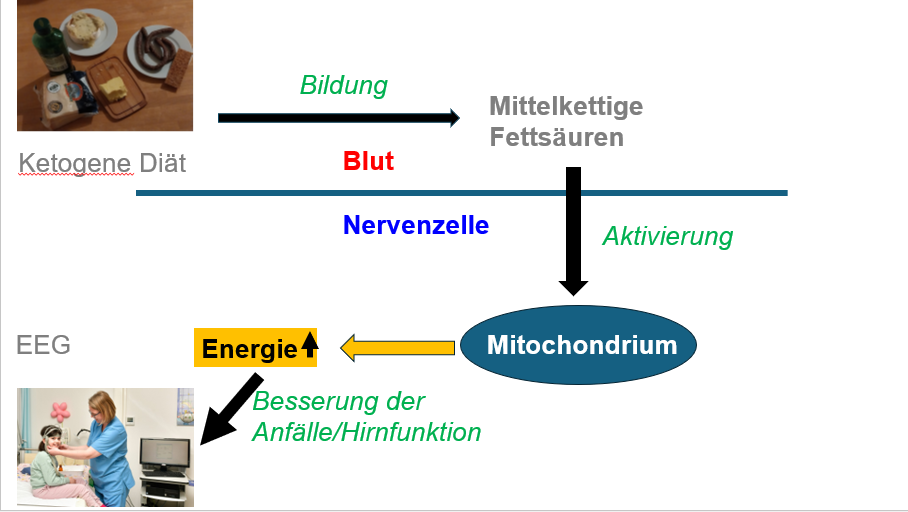 Die Grafik skizziert Stoffwechselwege: Aus fettreichen Lebensmitteln bilden sich mittelkettige Fettsäuren, die die Blut-Hirn-Schranke passieren. Sie aktivieren ein Mitochondrium, das Energie liefert und die Hirnfunktion verbessert. Das lässt sich im EEG eines Kindes erkennen. 